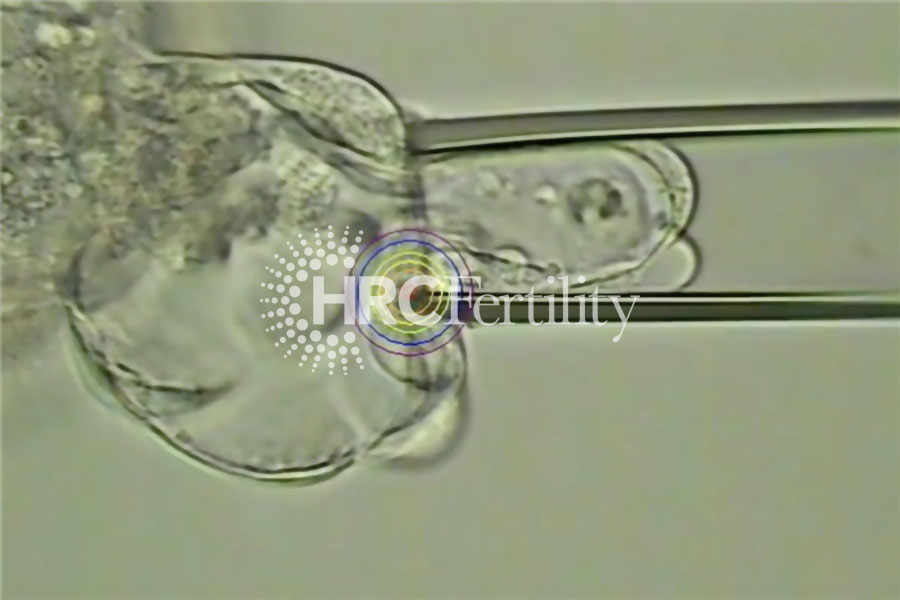 细胞提取-囊胚900.jpg