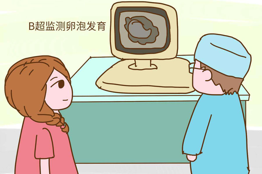 卵泡监测900.jpg