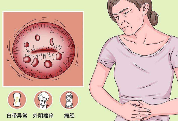 宫颈囊肿3.png