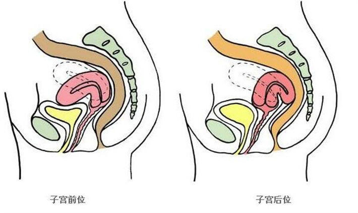 子宫后位.jpg