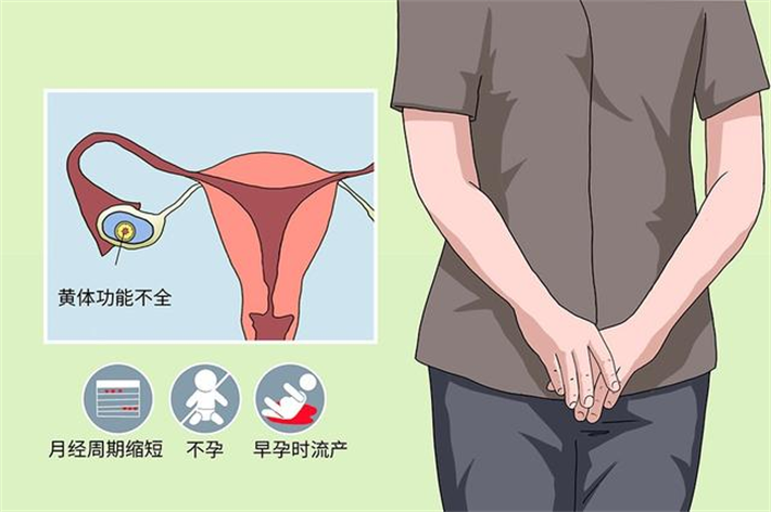 黄体功能不全.png