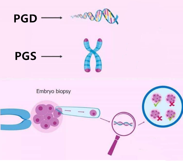 pgs/pgd技术