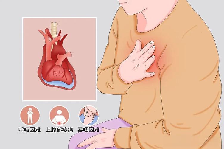 心包积液