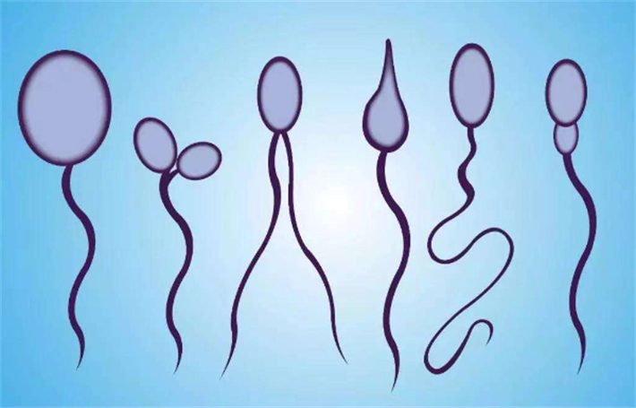 精子形态