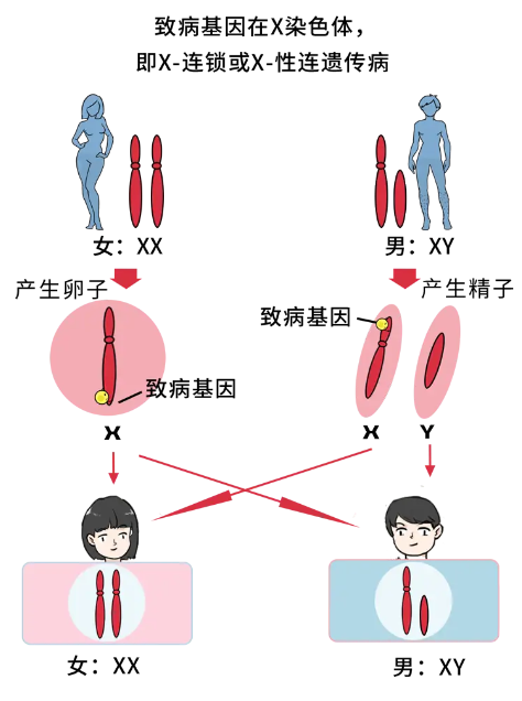 性连锁遗传病