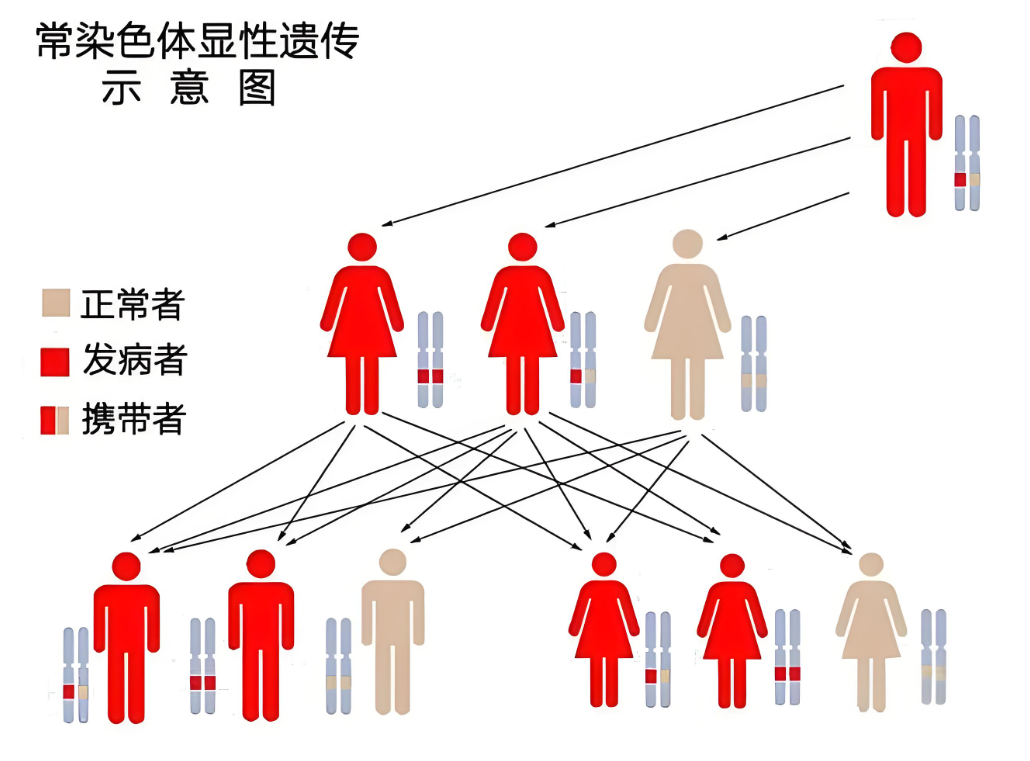 常染色体显性遗传