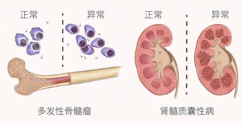 范可尼贫血症状
