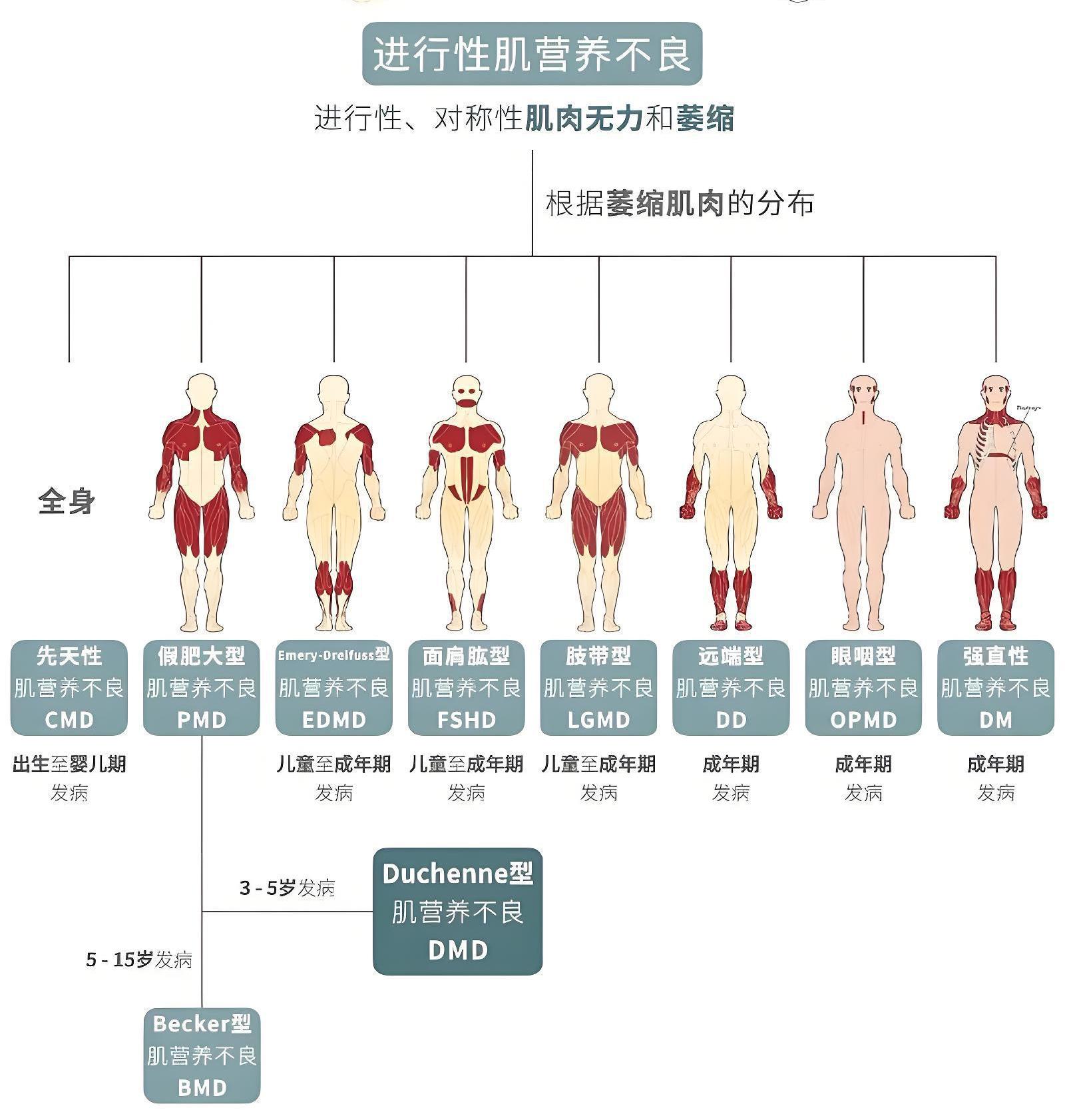 杜氏肌营养不良
