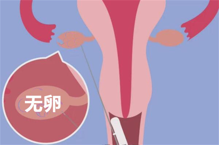 取卵失败