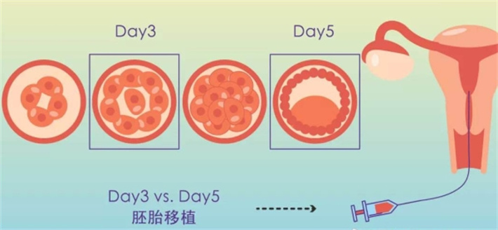 胚胎移植