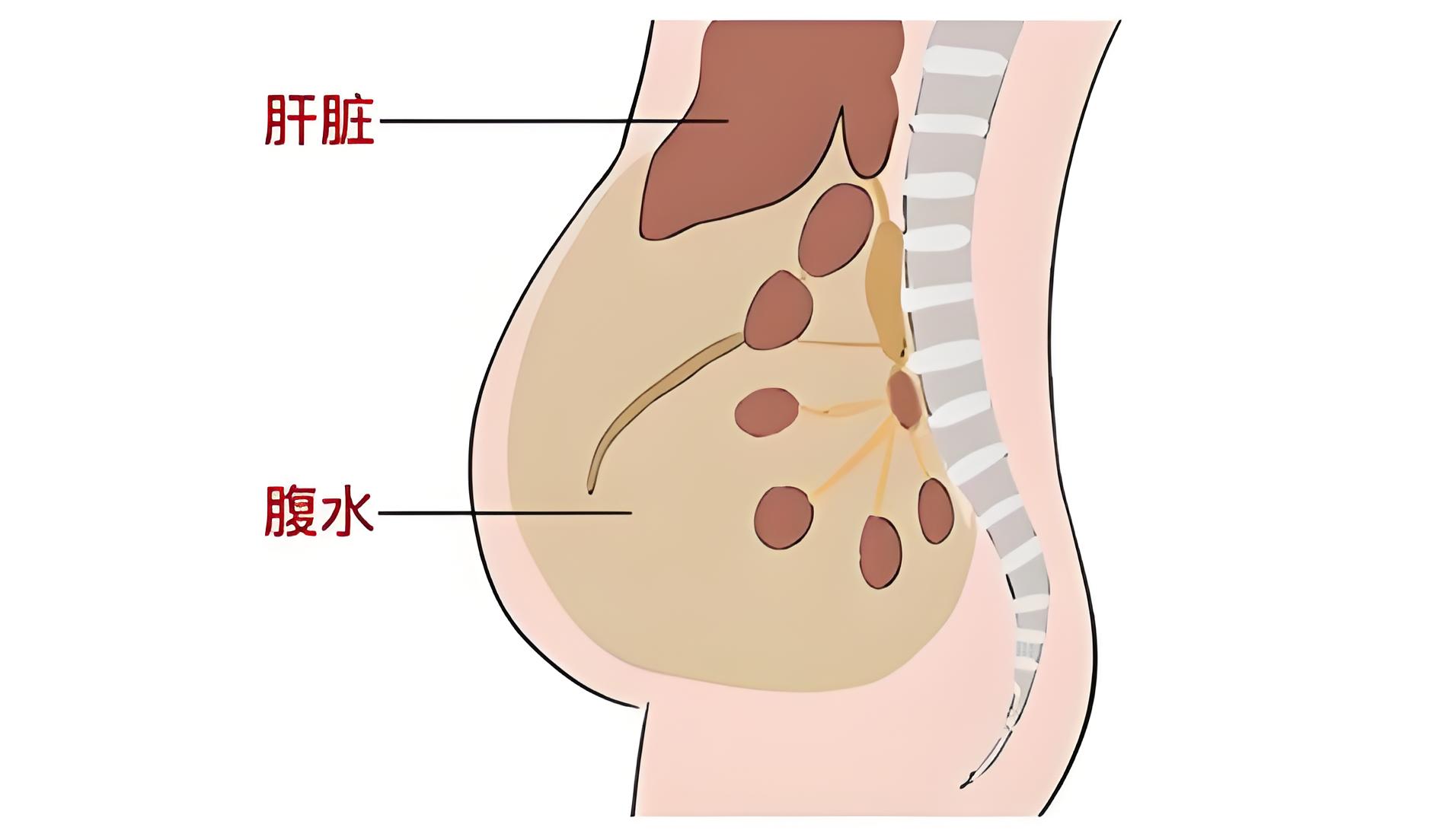 肝肾功能受损