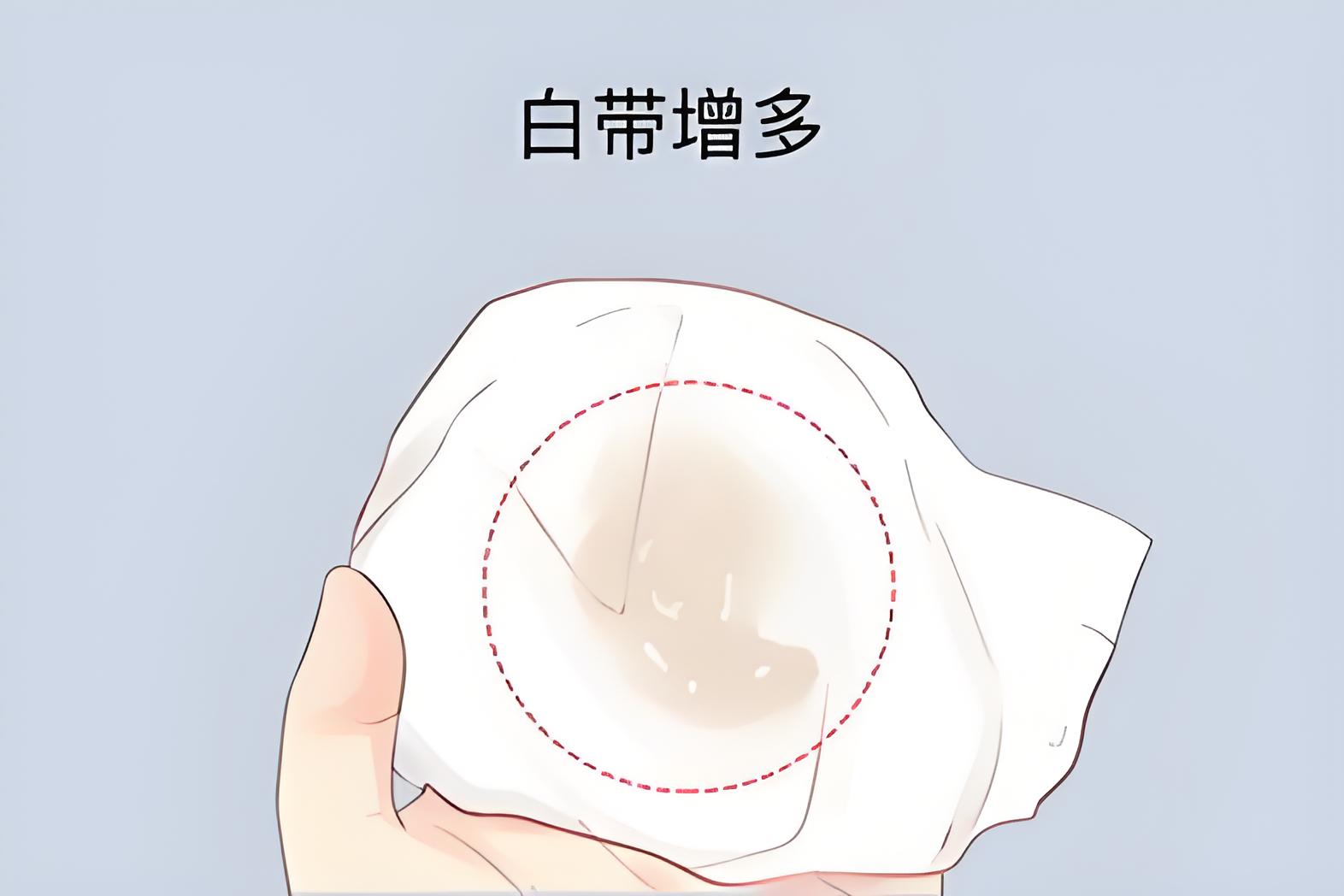 白带增多