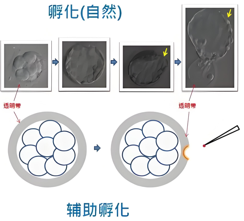 辅助孵化.png