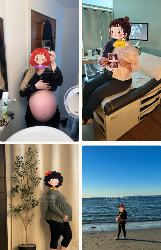 赴美试管成功怀孕案例