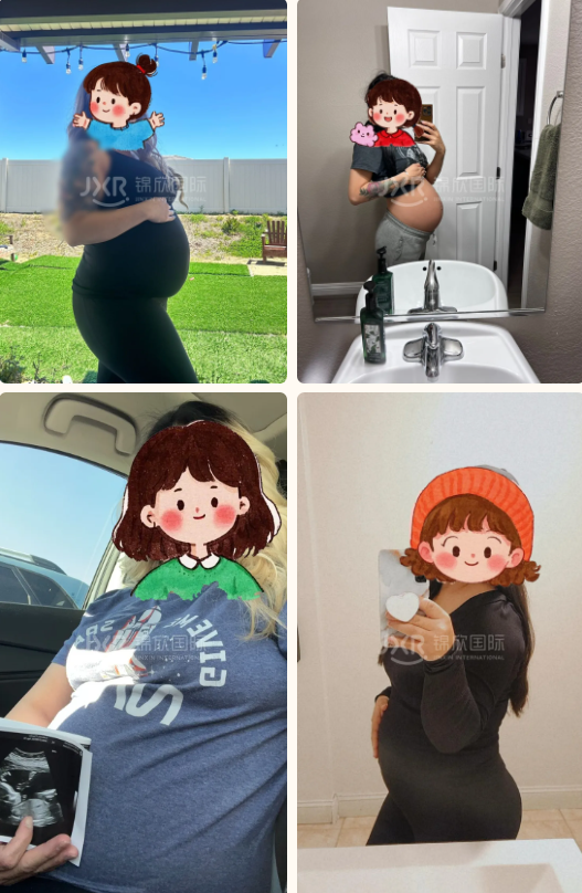 赴美试管客人的怀孕照片