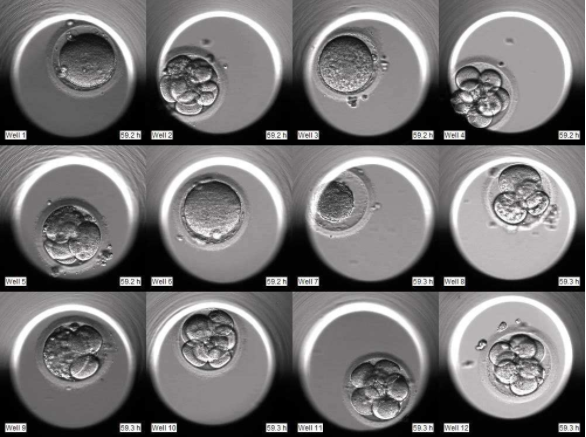 胚胎分裂照片