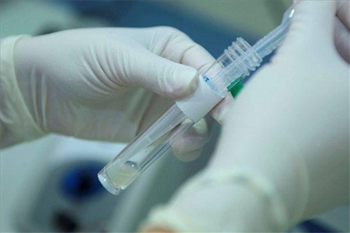 精子研究