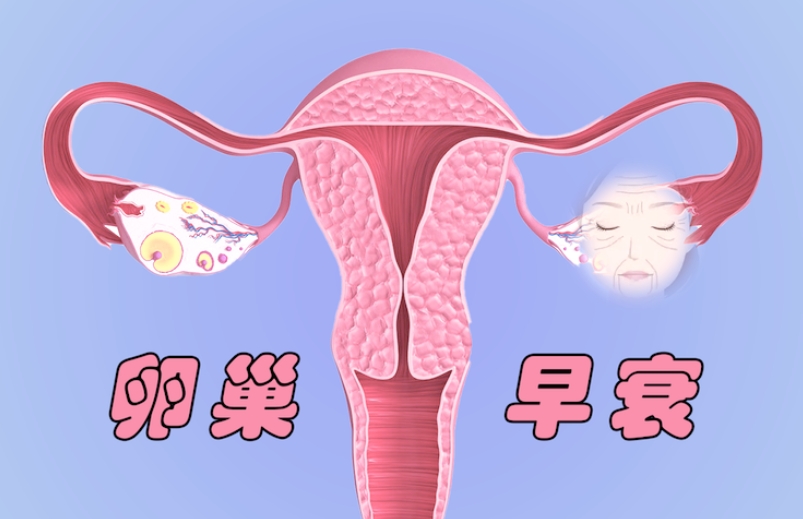 卵巢早衰.png