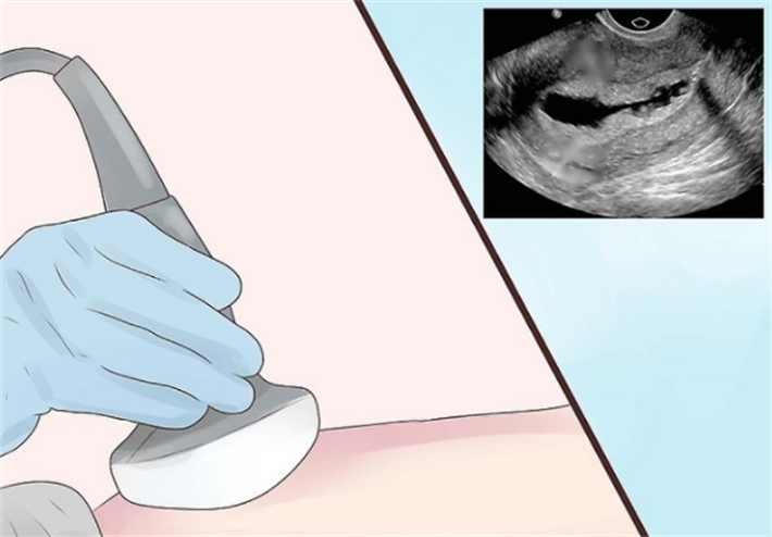 积极治疗输卵管炎