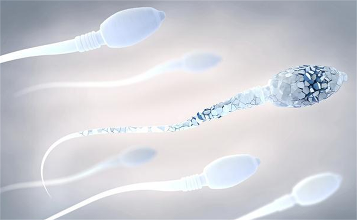 精子DNA碎片化