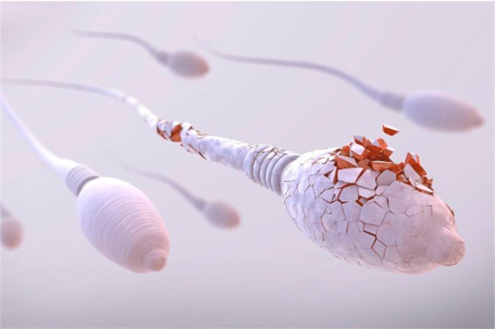 男性精子质量差