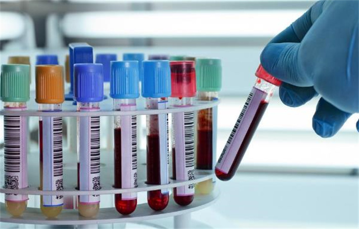 试管前血压检查