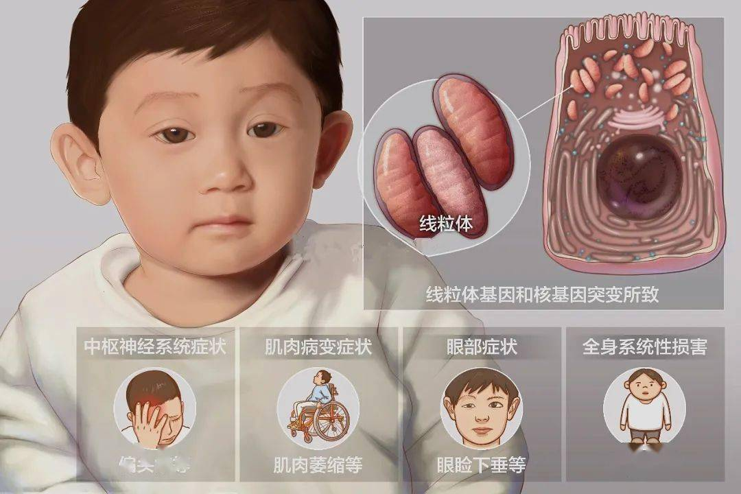 线粒体疾病