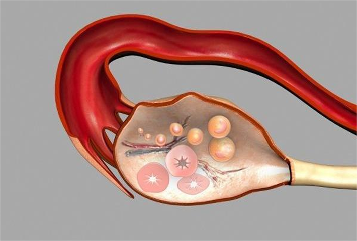 卵巢储备功能严重下降者