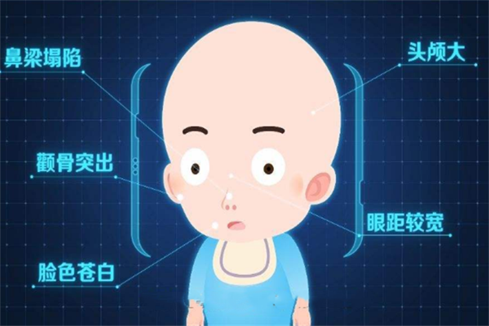 新生儿患地中海贫血