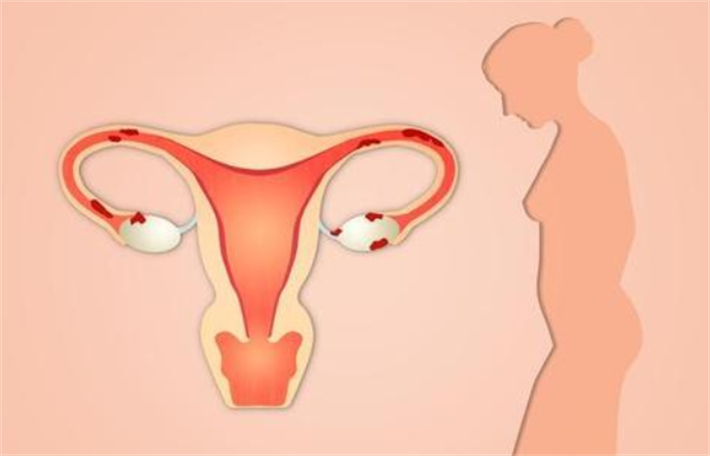 子宫内环境差