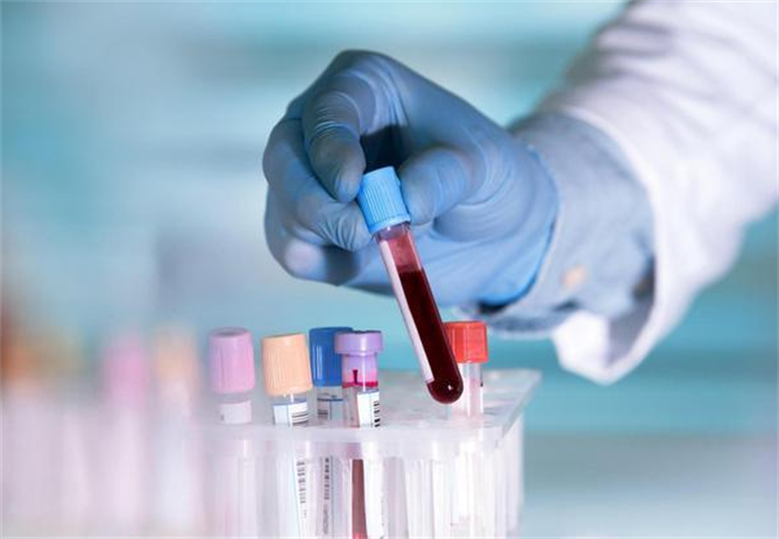血液检查