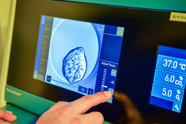 胚胎培养箱拍照