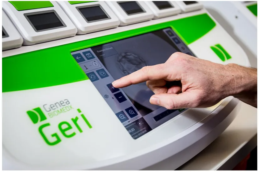 Geri®时序培养系统