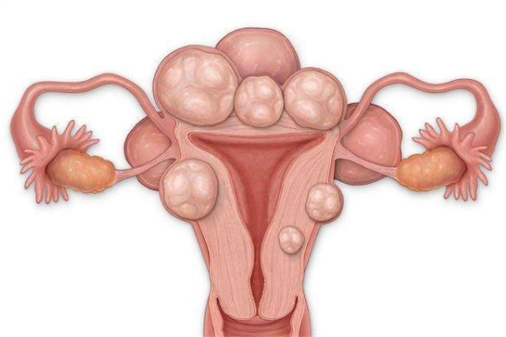 为特殊方案留出空间