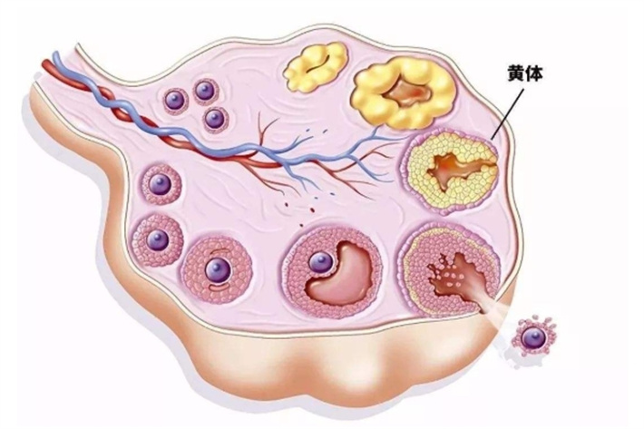 卵泡黄素化不破裂综合征