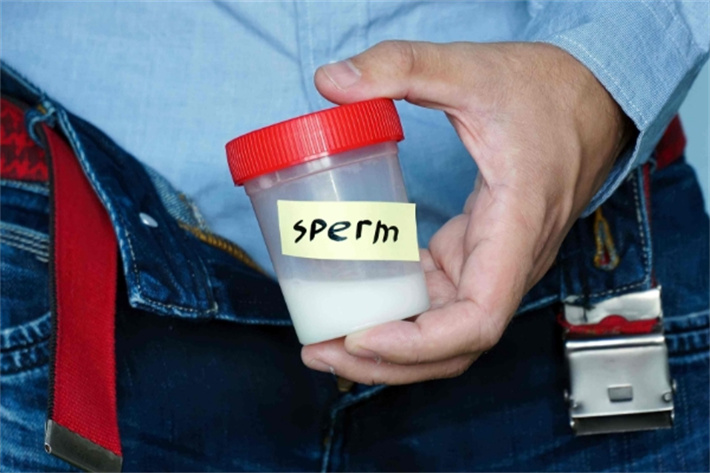 精液检查