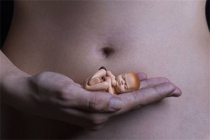 反复流产妊娠失败