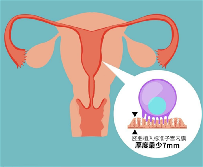 提高子宫内膜容受性