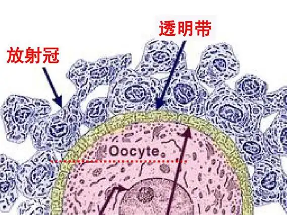 透明带增厚