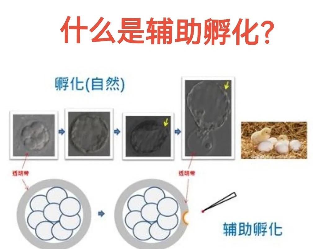 辅助孵化