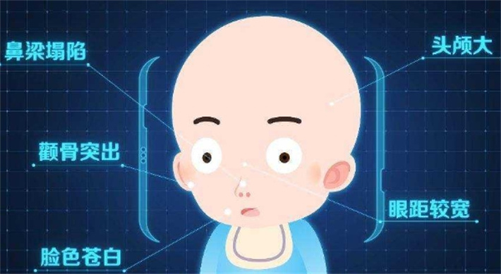 地中海贫血表现