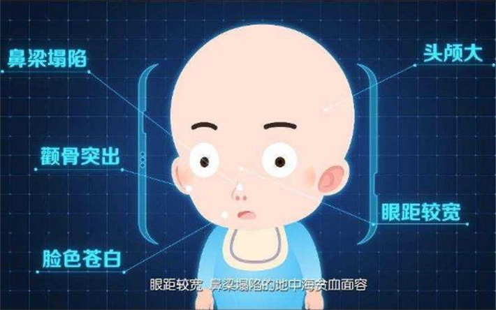 地中海贫血症