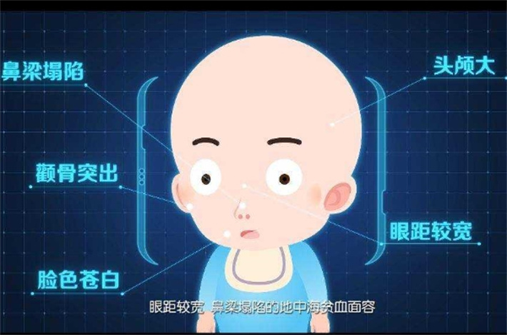 地中海贫血
