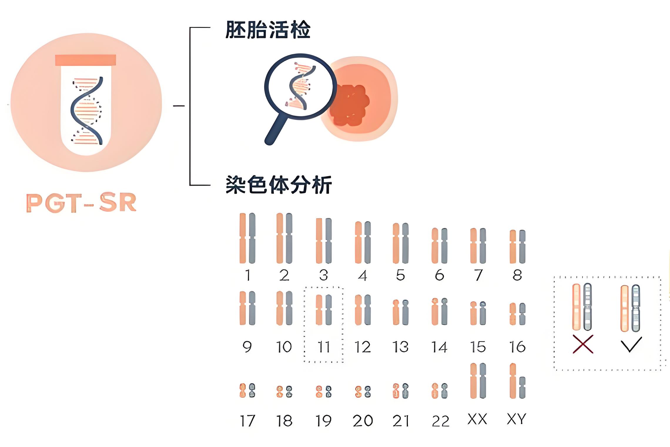 PGT - SR技术
