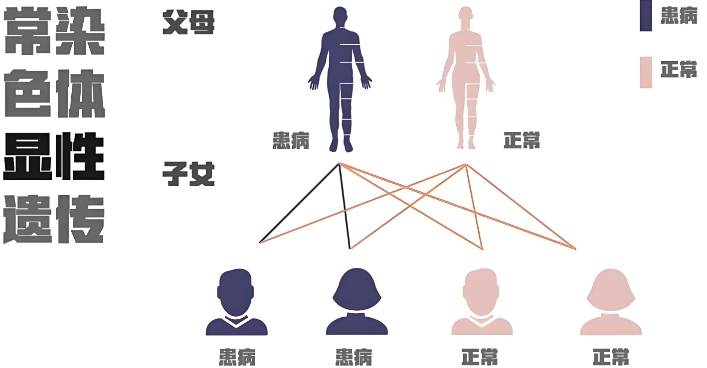 常染色体显性遗传.png
