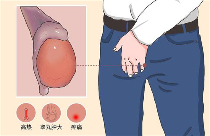 梗阻性无精症
